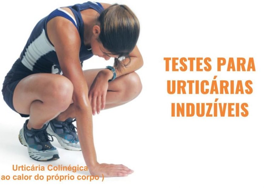 TESTES PARA URTICÁRIAS INDUZÍVEIS