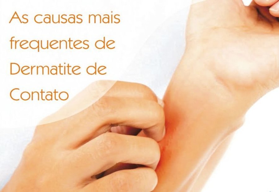 CAUSAS FREQUENTES DE DERMATITE DE CONTATO