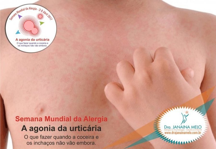 SEMANA MUNDIAL DA ALERGIA