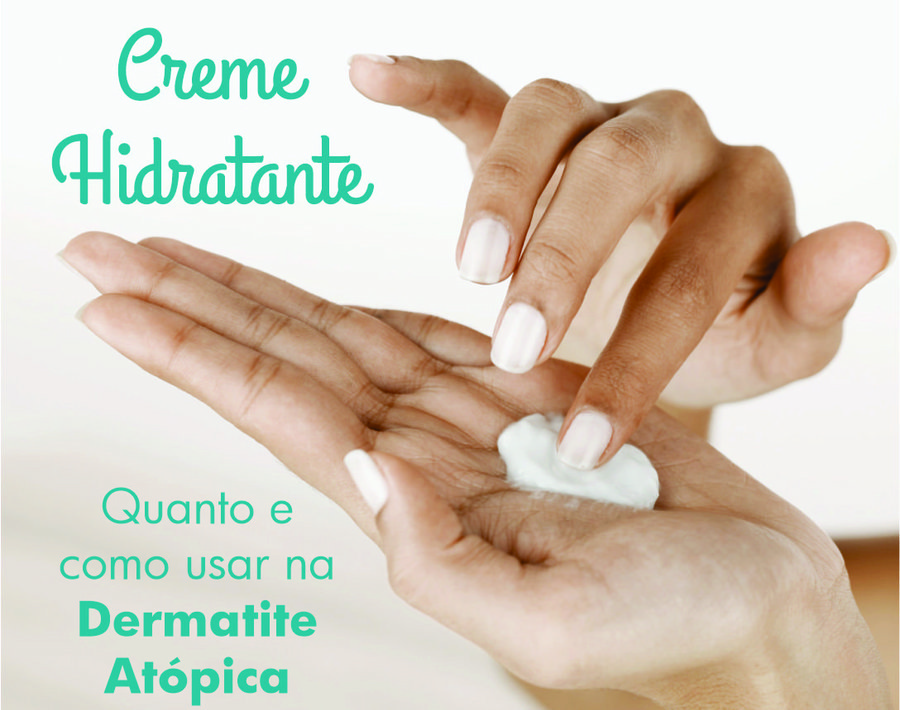 Creme Hidratante Dermatite Atópica Dra Janaina Melo Instituto De