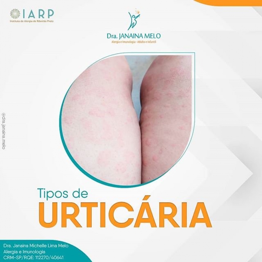 Tipos de Urticária