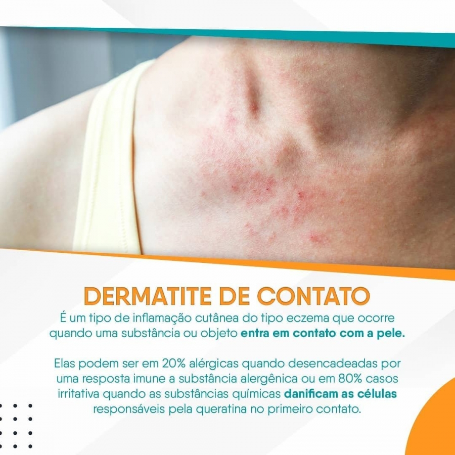 Dermatite de Contato