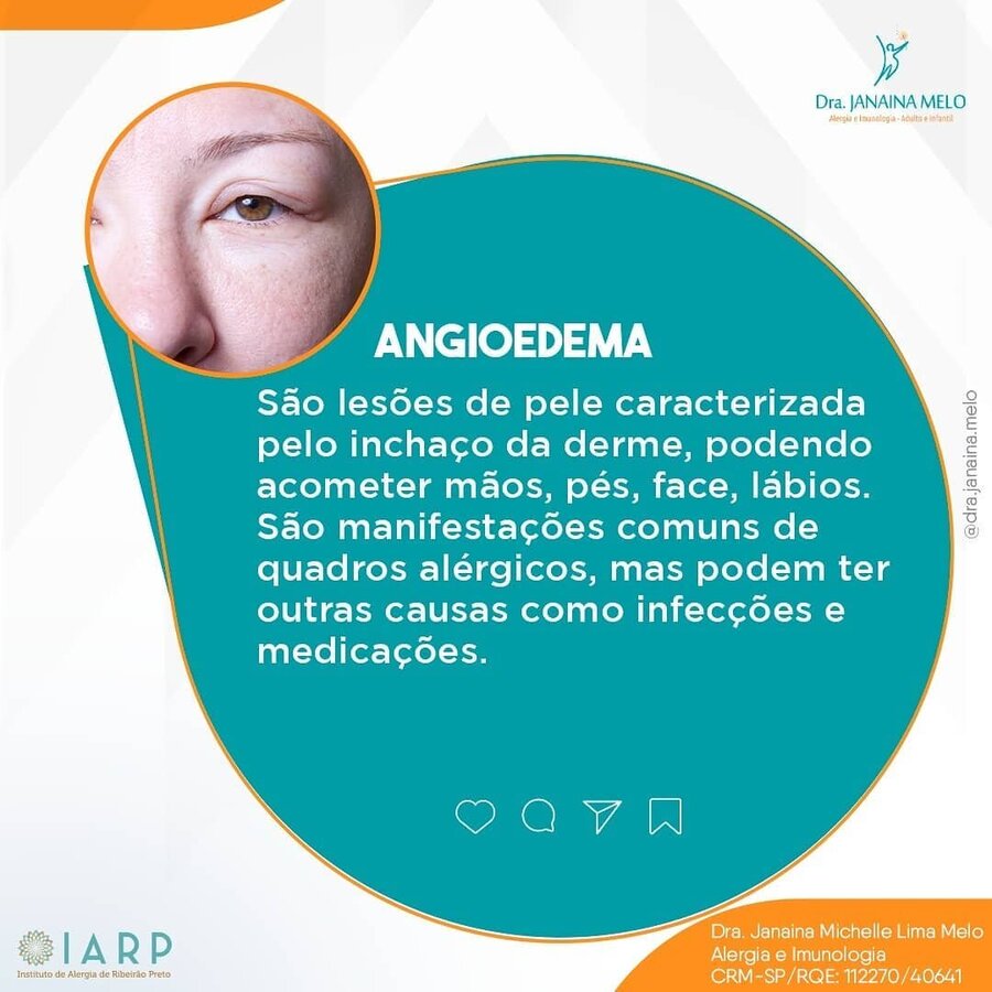 Angioedema!