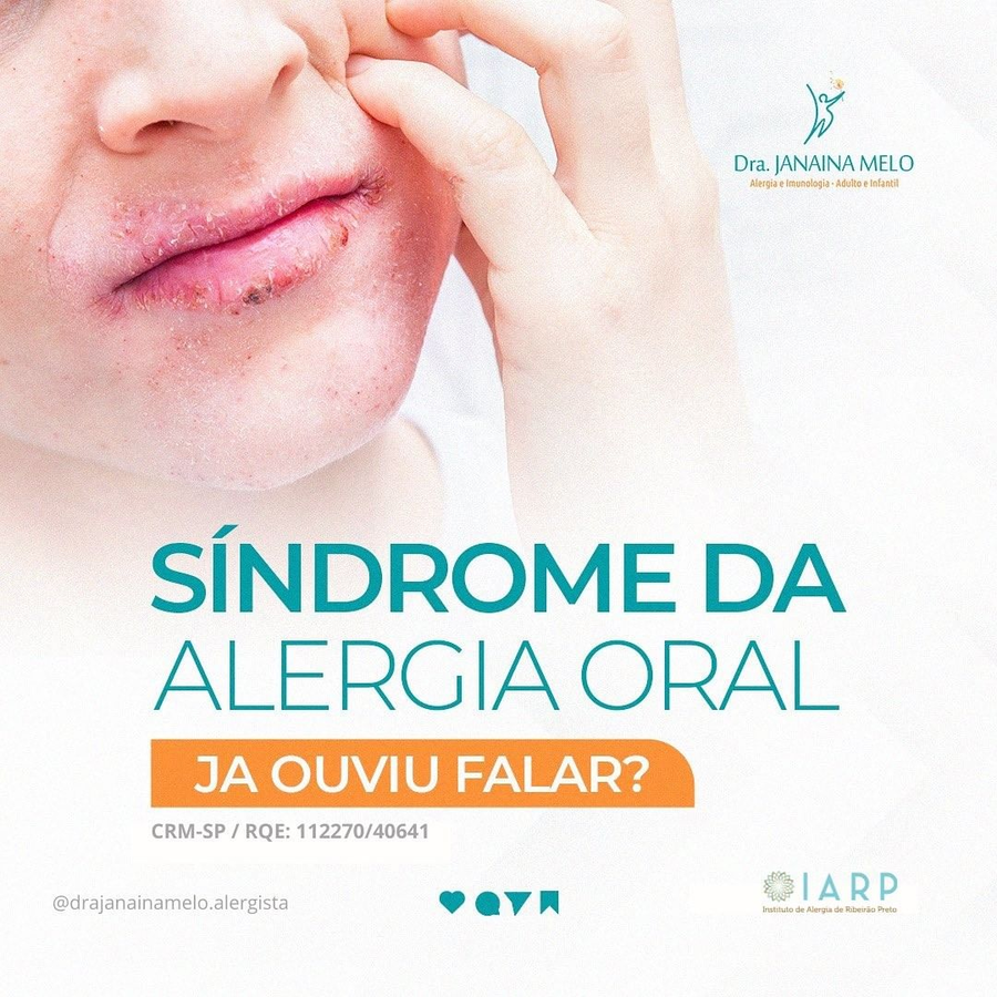 Já ouviu falar da síndrome da alergia oral?