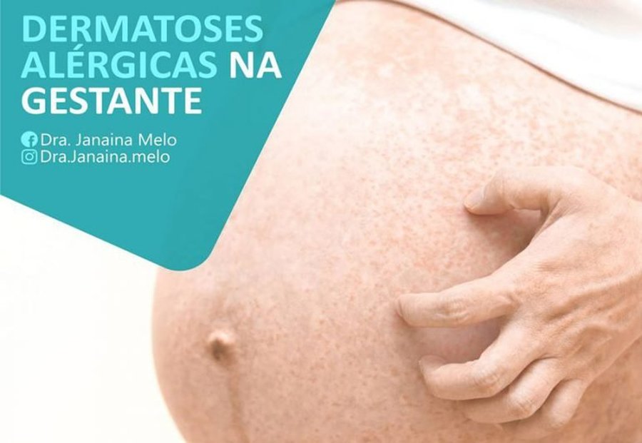 DERMATOSES ALÉRGICAS NA GESTANTE